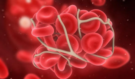 Американские медики научили смартфон определять свертываемость крови