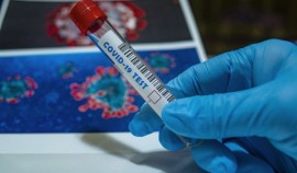 В Чеченской Республике за сутки выявили 38 случаев коронавируса