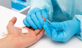 В Чеченской Республике с 27 декабря наблюдается снижение ежедневных случаев заражения COVID-19