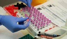 В России провели более 77 млн тестов на COVID-19