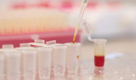 В ЧР ведётся подготовка к предварительному анализу семенного сырья