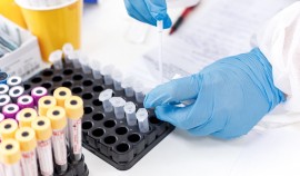 В Чеченской Республике проведено более полумиллиона тестов на COVID-19