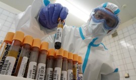 Роспотребнадзор напомнил о правилах сдачи теста на коронавирус