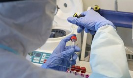 За последние сутки в России выявлено 15 700 заболевших COVID-19